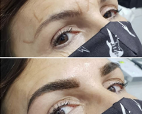 estetica unisex lecera